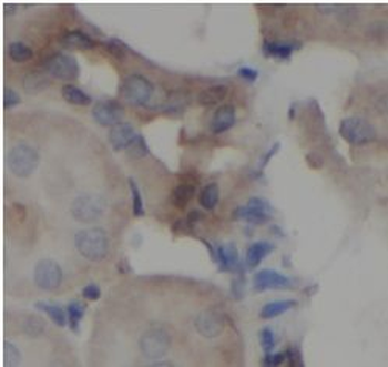 IKBKG Rabbit Polyclonal Antibody