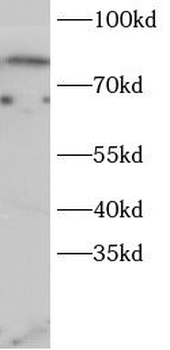 FOXO1 Antibody