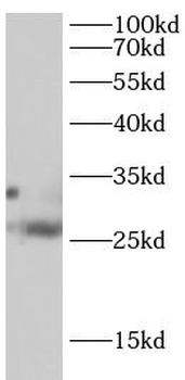 TRADD Antibody