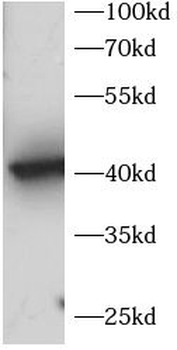 TBP Rabbit Polyclonal Antibody