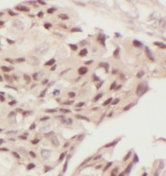 TBP Rabbit Polyclonal Antibody