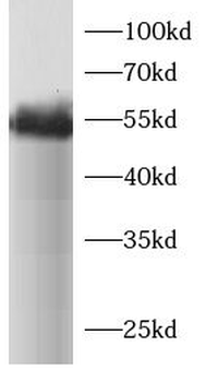 IRF3 Rabbit Polyclonal Antibody