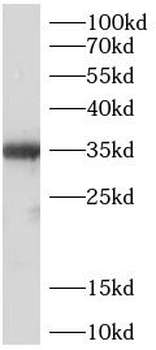 MYD88 Mouse Monoclonal Antibody