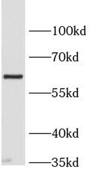 SLC2A9 Rabbit Polyclonal Antibody