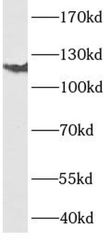 ITGA6 Rabbit Polyclonal Antibody