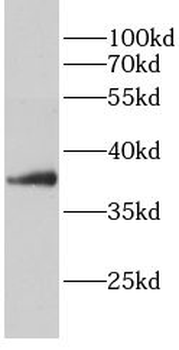 PPP1CA Antibody