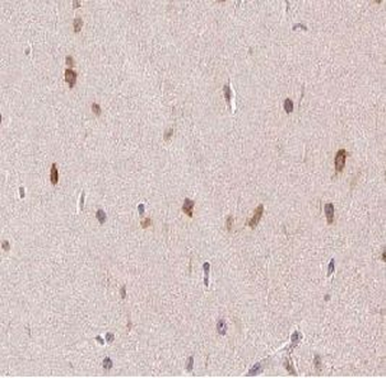 PPP1CA Antibody