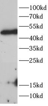 HDAC8 Antibody
