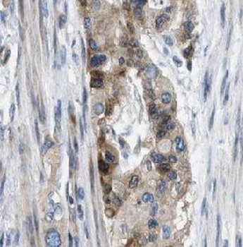 PPP1CC Antibody