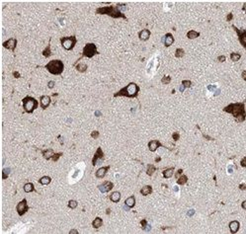 SLC6A4 Antibody
