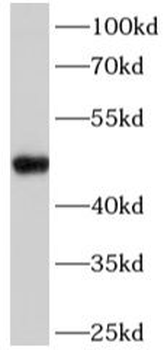 FADS2 Rabbit Polyclonal Antibody