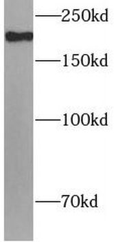 MRC2 Rabbit Polyclonal Antibody