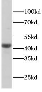 ADIPOR1 Mouse Monoclonal Antibody