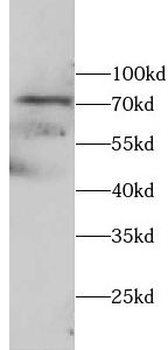 DHX58 Antibody