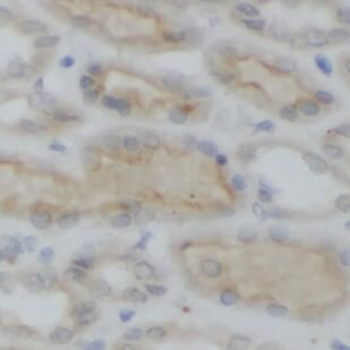 DHX58 Antibody