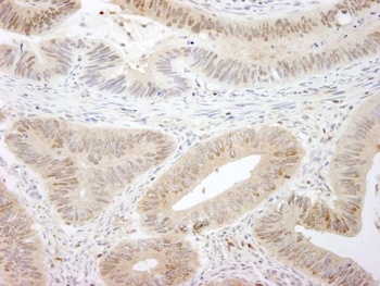 Rabbit MST1,2/STK3,4 IHC Antibody