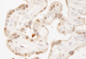 Rabbit MST1,2/STK3,4 IHC Antibody