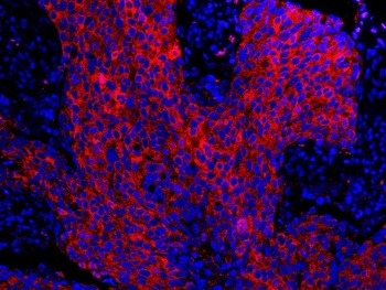 Rabbit anti-14-3-3 Sigma IHC Antibody