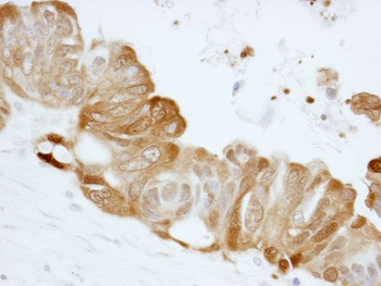 Rabbit anti-14-3-3 Sigma IHC Antibody