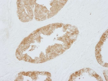 Rabbit anti-14-3-3 Sigma IHC Antibody