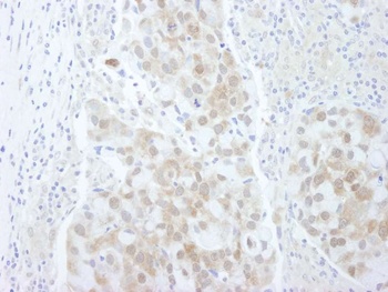 Rabbit anti-4EBP1 IHC Antibody