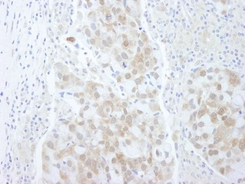 4EBP1 Antibody