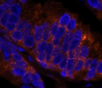 Rabbit 4E-T(eIF4E-T) IHC Antibody