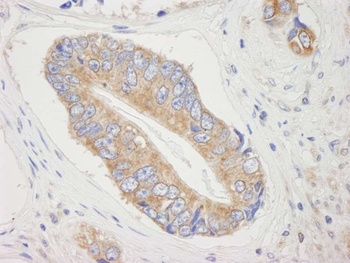 Rabbit 4E-T(eIF4E-T) IHC Antibody