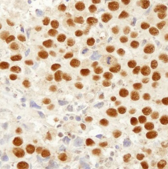 Rabbit MSH2 IHC Antibody