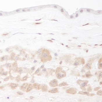 Rabbit PBEF IHC Antibody