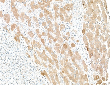 Goat Human C-Reactive Protein (CRP) Antibody