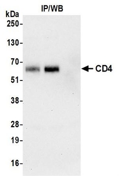 Rabbit anti-CD4 Recombinant Monoclonal Antibody