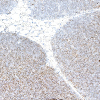 Rabbit anti-CD4 Recombinant Monoclonal Antibody