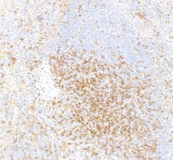 Rabbit anti-CD4 Recombinant Monoclonal Antibody