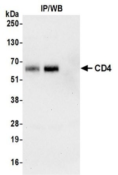 CD4 Antibody