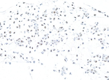 Rabbit anti-MSH2 Recombinant Monoclonal Antibody