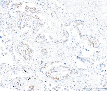 Rabbit anti-MSH2 Recombinant Monoclonal Antibody