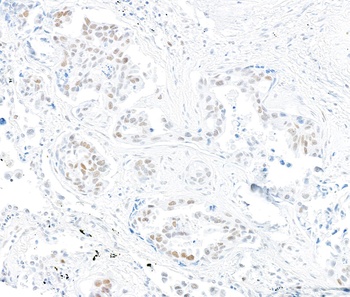 MSH2 Antibody