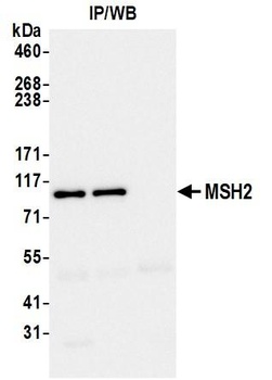 Rabbit anti-MSH2 Recombinant Monoclonal Antibody