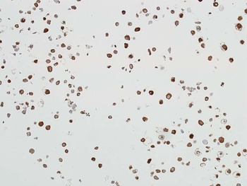 Rabbit anti-ALDH1A1 Recombinant Monoclonal Antibody