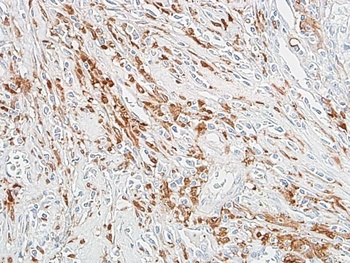 Rabbit anti-ALDH1A1 Recombinant Monoclonal Antibody