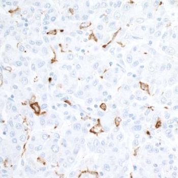 Rabbit anti-CD163 Recombinant Monoclonal Antibody
