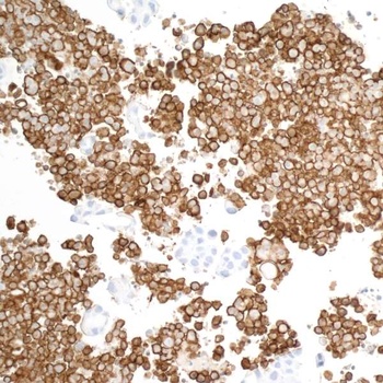 Rabbit anti-CD163 Recombinant Monoclonal Antibody
