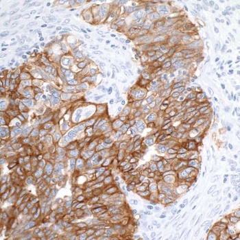 Rabbit anti-EpCAM Recombinant Monoclonal Antibody