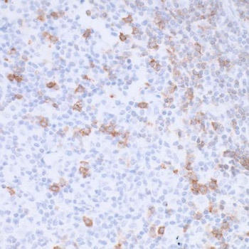 Rabbit anti-PD-1 Recombinant Monoclonal Antibody