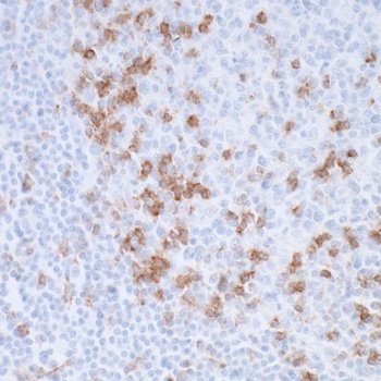 Rabbit anti-PD-1 Recombinant Monoclonal Antibody