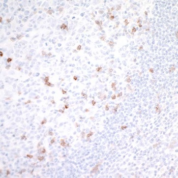 Rabbit anti-GITR/TNFRSF18 Recombinant Monoclonal Antibody