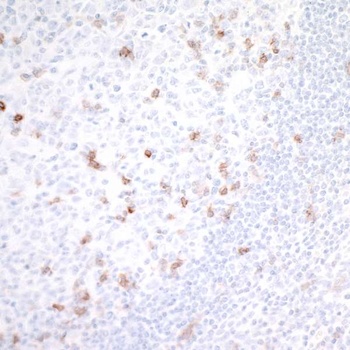 GITR/TNFRSF18 Antibody