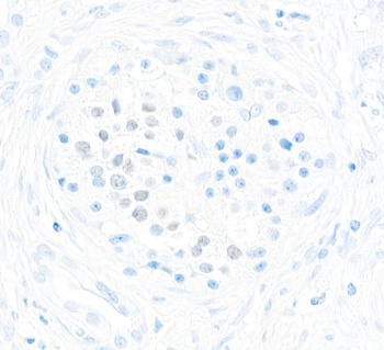 Rabbit anti-MafA Recombinant Monoclonal Antibody