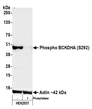Rabbit anti-Phospho BCKDHA (S292) Recombinant Monoclonal Antibody